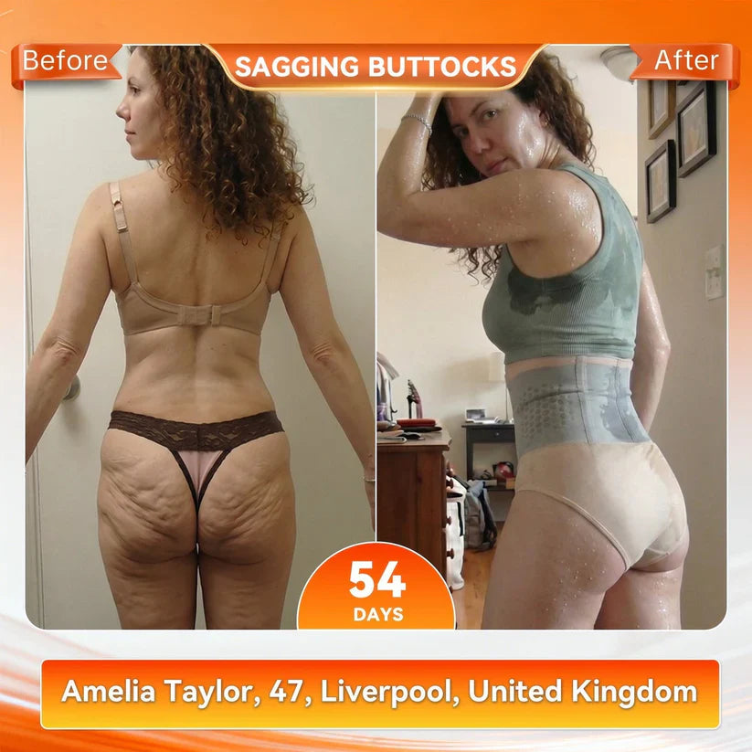 4‑In‑1 Micro‑Particle Sculpting & Fat‑Burn Shorts (Buy 1 Get 1 FREE)